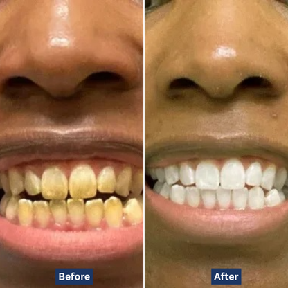 ToothArmor™ Enamel Armor Drops